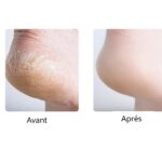 Exfoliant pour les pieds Kemei KM-6865 – Image 2